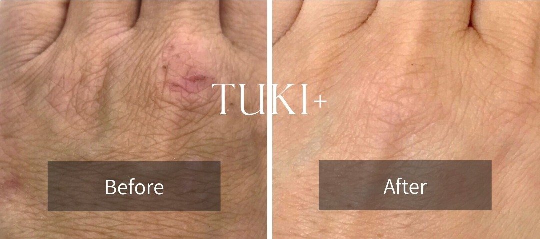 手の甲の記録