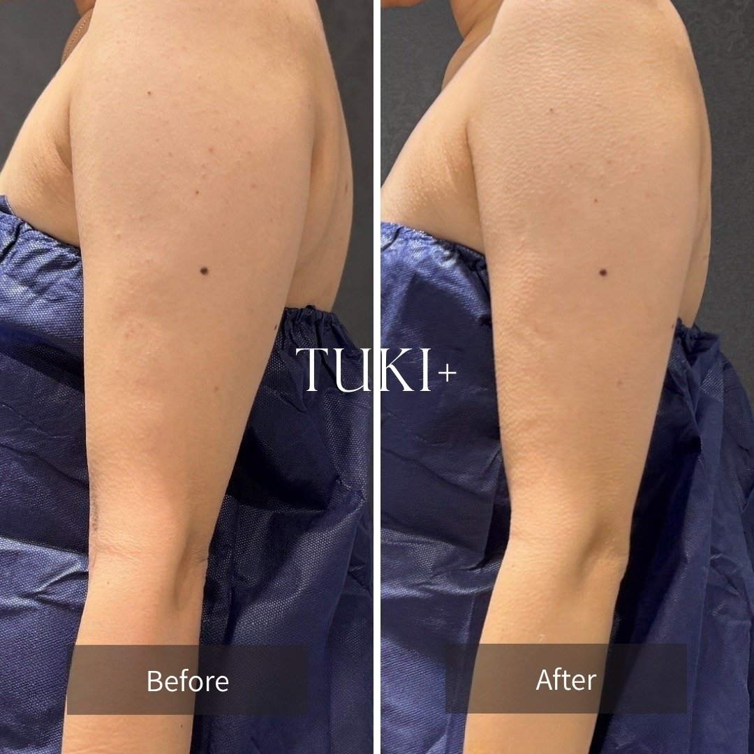 二の腕の記録